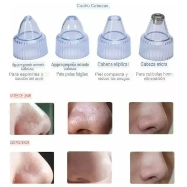Extractor de Puntos Negros 4 Cabezales - Imagen 5