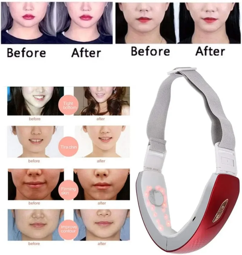 Adelgazante Facial con Fototerapia LED y EMS - Imagen 2