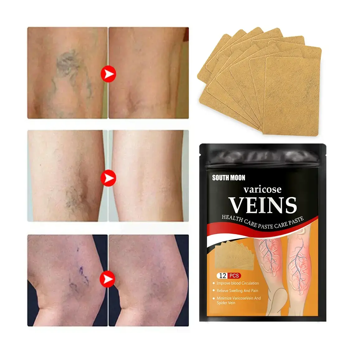 Parches para Várices - Imagen 2